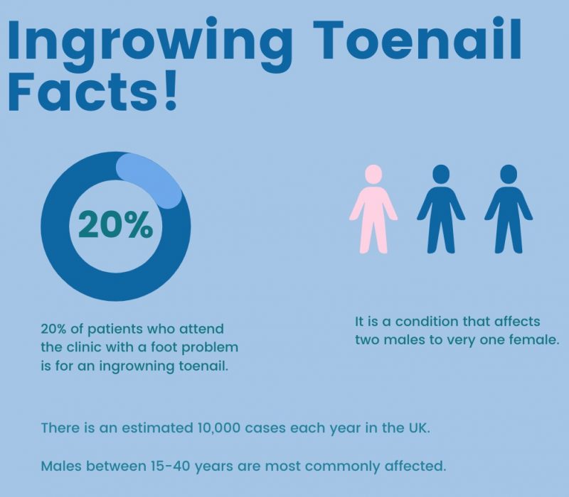 Ingrowing toenail facts